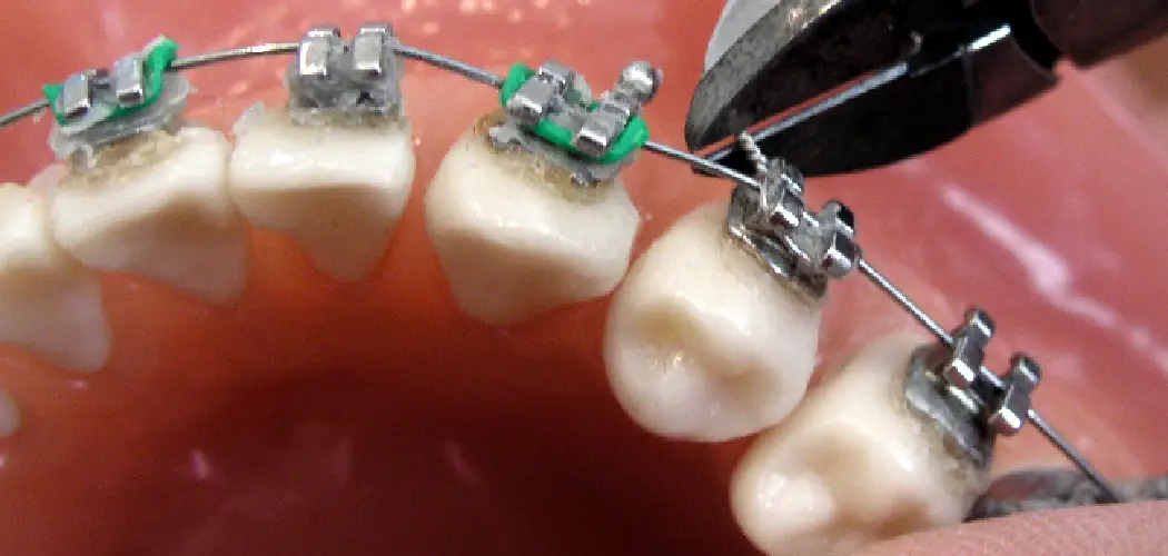 How to Cut Braces Wire With Scissors